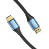 HDMI 2.0 Cable Vention ALHSH, 2m, 4K 60Hz, 30AWG (Blue)