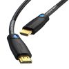 Kábel HDMI Vention AAMBJ, 5m, 4K 60Hz (Czarny)