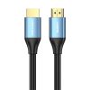 HDMI 2.0 Cable Vention ALHSI, 3m, 4K 60Hz, 30AWG (Blue)